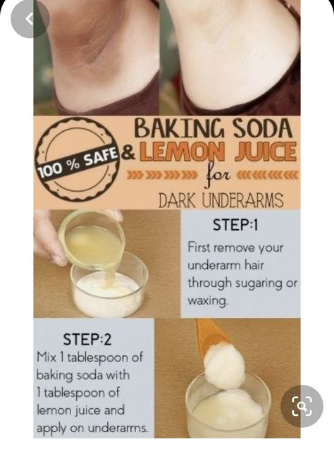 For Dark Underarms, Dark Armpits, Lemon Benefits, Dark Underarms, Baking Soda Shampoo, Diy Remedies, Natural Therapy, Skin Care Remedies, Diy Health