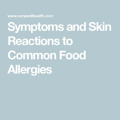 Symptoms and Skin Reactions to Common Food Allergies Food Allergy Symptoms, Swollen Lips, Common Food Allergies, Be Serious, Allergy Symptoms, Food Allergy, Chiropractic Care, One By One, Chiropractic