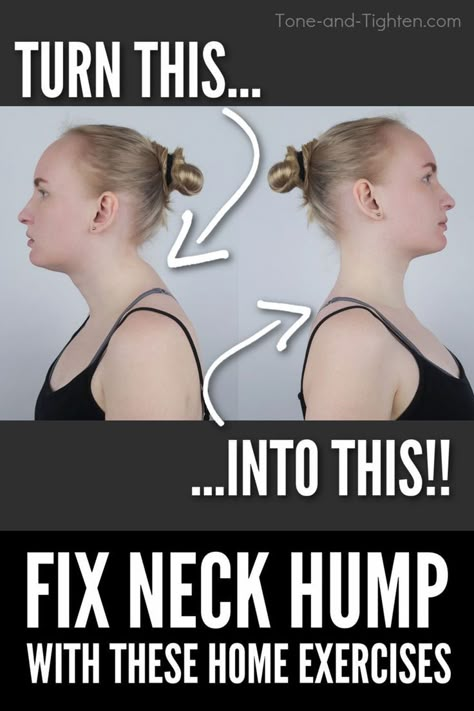 #fixneckhump #getridbuffalohump #dowager'shump https://youtu.be/IalHpGOKuG0 neck hump exercises,buffalo hump,how to correct a neck hump,how to fix a neck hump,fix for neck hump exercises,simple fix for neck hump,quick 4 minute fix for neck hump,easy fix for the neck hump,how to fix a neck hump at home,how to get rid of a neck hump,neck hump workout,fix neck hump,exercises for neck hump,how to treat a neck hump home,neck buffalo hump,physical therapy,hunchback exercises at home,dowagers hump Hunchback Exercises, Fix Neck Hump, Dowagers Hump, Dowager Hump, Neck Fat Exercises, Exercises For Neck, Dowager's Hump, Posture Stretches, Osteoporosis Exercises