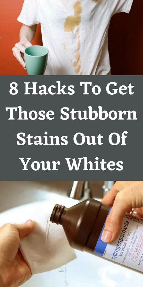 Diy Stain Remover, Chocolate Stains, Diy Staining, Stain On Clothes, Deodorant Stains, Dirt Stains, Red Stain, Household Cleaning Tips, White Table Cloth