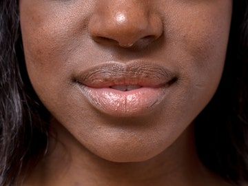 Dry Lips Remedy, Chapped Lips Remedy, Lip Care Tips, Natural Acne Remedies, Cold Cream, Get Rid Of Blackheads, Facial Exercises, Black Lips, Dark Lips