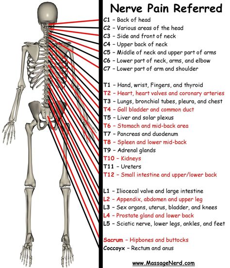 Nerve pain----- Massage Pictures, Referred Pain, Spine Health, Nerve Pain Relief, The Nervous System, Nerve Pain, Anatomy And Physiology, The Human Body, Neck Pain