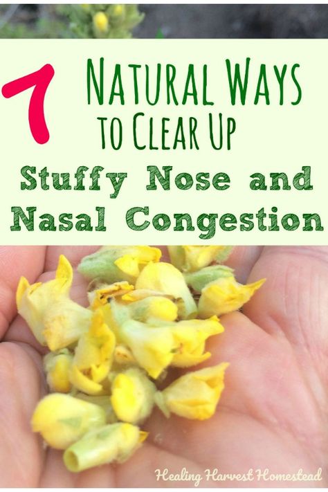 Here are seven natural ways you can get rid of congestion fast! Find out how to stop your stuffy nose so you can breathe again. Sinus congestion is no fun, and these are easy home remedies that really work to help stop nasal congestion in its tracks and unclog your poor stuffed up nose. Get Rid Of Congestion Fast, Natural Remedies For Congestion, Remedy For Sinus Congestion, Chest Congestion Remedies, Congestion Remedies, Sinus Remedies, Home Remedies For Sinus, Natural Decongestant, Stuffy Nose Remedy