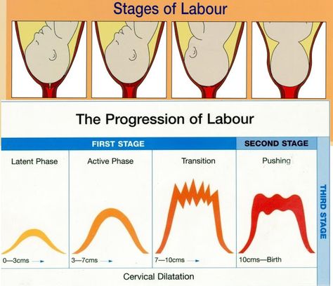 Stages of Labor and Delivery | Understanding the Stages of Labour is Laborious Newborn Nursing, Midwifery Student, Child Nursing, Student Midwife, Labor Delivery Nursing, Stages Of Labor, Labor Nurse, Mother Baby Nurse, Nursing Mnemonics