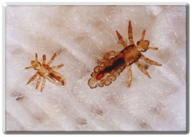 Nymphs (baby lice) these are teeny tiny lice, about a week from becoming adults Lice Pictures, How To Treat Lice, Hair Lice, Lice Removal, Head Louse, Sesame Seed, The Buffalo, Roots Hair, Health Info