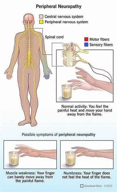 Cmt Disease, Simple Daily Routine, Nerve Pain Remedies, Chinese Cupping, Brain And Spinal Cord, Numbness In Hands, The Peripheral, Student Tips, Peripheral Nervous System