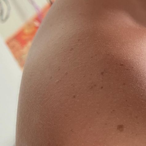 Leg Freckles, Tanned Skin With Freckles, Tan Skin And Freckles, Sun Kissed Freckles, Summer Freckles, Freckles On Tan Skin, Freckles Aesthetic, Body Freckles, Shoulder Freckles