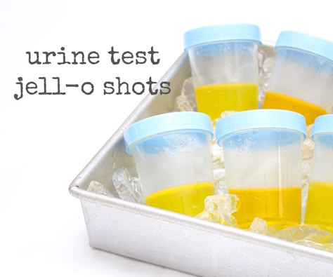 Urine test Jell-o shots are a great addition to any Halloween party! I mean, why make regular Jell-o shots when you can make ones that will gross people out? :DThese urine test Jell-o shots are amazingly simple too - just make them 4-6 hours before your party! Halloween House Party Decorations, Gross Halloween Foods, Adult Halloween Party Food, Medical Themed Parties, Nurse Grad Parties, Gross People, Halloween Eats, Medical Party, Haunted Hospital