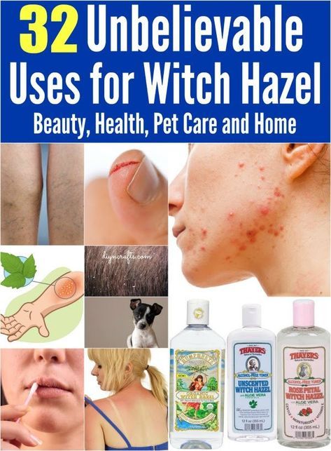 32 Unbelievable Uses for Witch Hazel: Beauty, Health, Pet Care and Home... Uses For Witch Hazel, Witch Hazel Uses, Hand Sanitizers, Body Care Products, Homemade Remedies, Witch Hazel, Pedro Pascal, Health And Beauty Tips, Natural Medicine