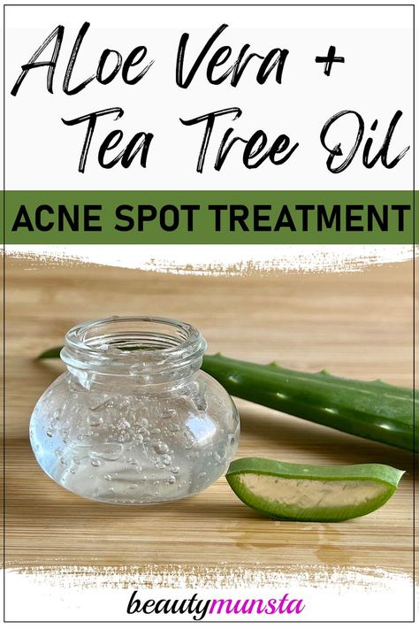 For acne and pimples, use this DIY acne remedy with aloe vera gel and tea tree oil. Aloe vera is cooling and healing for acne. It reduces redness and inflammation, calming down acne flares. Tea tree oil is highly anti-bacterial and is a great natural way of getting rid of acne or pimples. Benefits Of Aloe Vera Gel, Acne Remedy, Carrier Oils For Skin, Tea Tree For Acne, Tea Tree Oil For Acne, Blind Pimple, Acne Overnight, Pimples Remedies, Acne Gel