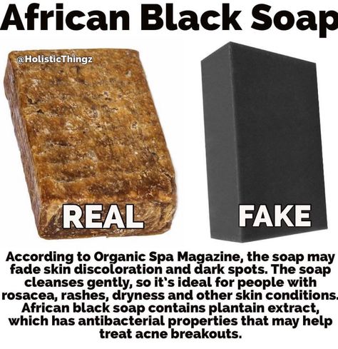 Raw African Black Soap, African Soap, Fade Skin, African Black Soap, Black Soap, Skin Discoloration, How To Treat Acne, Face Skin Care, Skin Tips