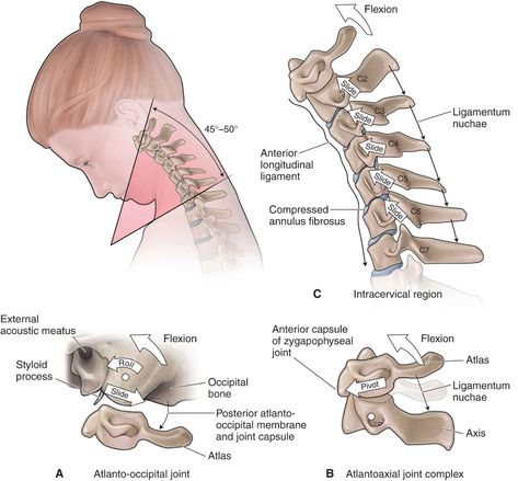 The Cervical Spine | Musculoskeletal Key Cervical Disc, Vertebral Artery, Thoracic Vertebrae, Intervertebral Disc, Gross Anatomy, Cervical Vertebrae, Spinal Nerve, Cervical Spine, Medical Anatomy