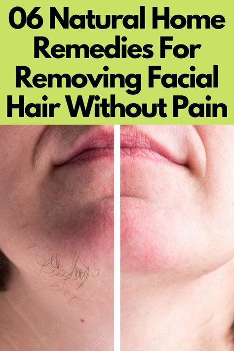 06 Natural Home Remedies For Removing Facial Hair Without Pain Removing Facial Hair Women, Homemade Hair Removal, Natural Facial Hair Removal, Diy Facial Hair Removal, Removing Facial Hair, Female Facial Hair, Best Facial Hair Removal, Face Hair Removal, Hair Removal Diy