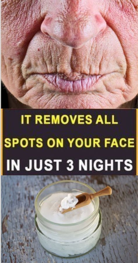 Just Rub Your Skin With This Spice And Your Wrinkles Will Disappear Home Remedies For Wrinkles, Anti Aging Remedies, Homemade Wrinkle Cream, Wrinkle Remedies, Wrinkle Free Skin, Erase Wrinkles, Skin Care Wrinkles, Saggy Skin, Face Wrinkles