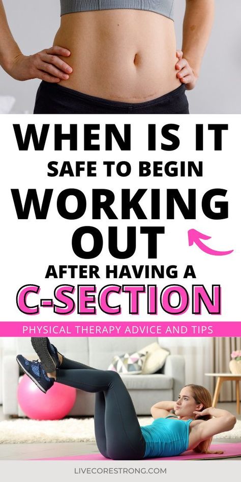 You just had a cesarean birth and you want to know when it is safe to begin working out after a C-section.You are absolutely determined to have a smooth recovery. Exercise is definitely a part of your postpartum journey goals, and now it’s time to figure out what is safe and what is not safe to do for your postpartum workout. This physical therapist and a mom of 4 answers all your C-section postpartum workout questions here in this article. Click to continue. Exercise For Post C Section, After C Section Exercise, Postpartum Workout For C Section, Postpartum C Section Workout Plan, Workout For Postpartum, Postpartum Workout After C Section, Post C Section Workouts, Post Partum C Section Exercises, Postnatal Workout C Section