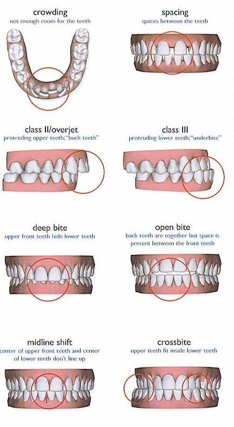 Dental Assistant School, Dental Hygienist School, Dental Assistant Study, Dental Hygiene Student, Dental Videos, Kedokteran Gigi, Dental Hygiene School, Dentistry Student, Dental Anatomy