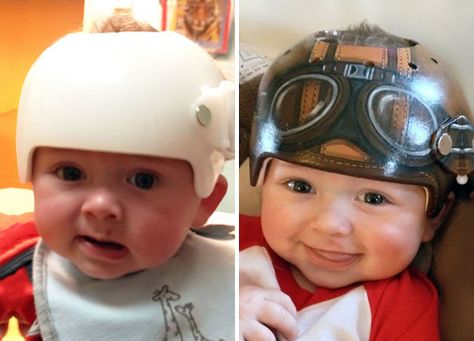 An artist is creating beautiful helmets for families with plagio and other cranial-shaping needs. Check these out! Plagiocephaly Helmets, Doc Band, Photo Bb, Baby Helmet, Helmet Head, Helmet Paint, Baby Center, Helmet Design, Baby Head