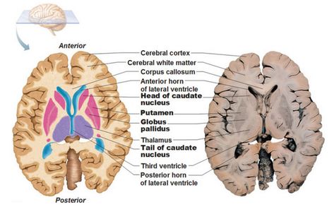 Relationship of the parts of Basal Ganglia to the Thalamus and Ventricles Basal Ganglia Anatomy, Caudate Nucleus, Basal Ganglia, Corpus Callosum, Cerebral Cortex, Grey Matter, Medical Student Study, White Matter, Brain Anatomy