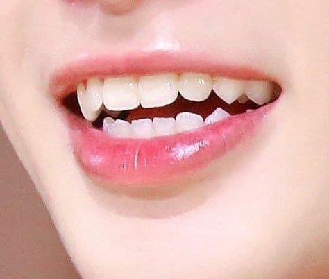 Teeth Aesthetic, Pretty Teeth, Fantasy Story Ideas, Cute Tooth, Straight Teeth, Perfect Teeth, Vampire Teeth, Face Reference, Beautiful Lips