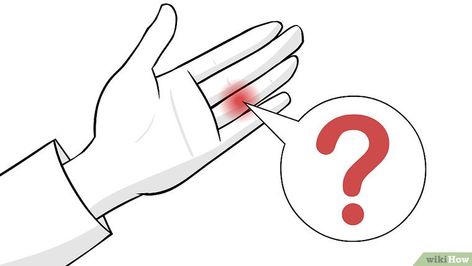 Doctor-Approved Advice on How to Treat a Jammed Finger - wikiHow Jammed Finger Remedies, Remove Ring From Swollen Finger, How To Get A Ring Off A Swollen Finger, How To Get A Splinter Out Of Your Finger, Sore Thumb Joints, Fractured Finger, Jammed Finger, Avulsion Fracture, Finger Injury