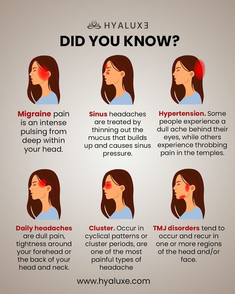 Types of Headaches, tag someone who finds this useful 💜 Follow us @hyaluxe for daily information like this #headache #migraines #magnesium What Causes Headaches, Headache Chart, What Causes Migraines, Types Of Migraines, Daily Headaches, Psychological Facts Interesting, Migraine Pain, Headache Types, Sinus Headache