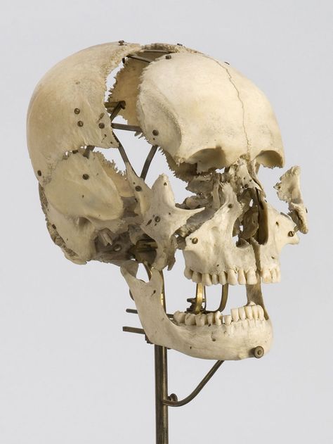 Surgeon and anatomist Edmé François Chauvot de Beauchêne invented a technique for taking apart the individual bones of the skull and reassembling them in a an "exploded" view. This specimen is from around 1880. Visual Vocabulary, Anatomy Bones, Skull Reference, Ancient Drawings, Hospice Nurse, Fossil Bones, Dark Artwork, Harvard Medical School, Muse Art