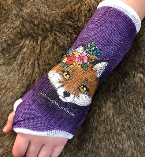 Fox & Floral Cast Art | Hand painted design using acrylic paint. Broken / fractured wrist. Colorful flowers, red fox art on purple child’s cast. Instagram User: @PinkiesAndPeonies (formerly @sweetpea_whimsy) Arm Cast Painting, Cast Art Arm, Broken Hand Cast, Arm Cast Decorating Ideas, Crutch Decorations, Ankle Fracture Recovery, Wrist Cast, Broken Arm Cast, Cast Painting