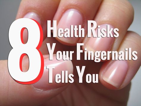 8 Health Risks Your Fingernails Tells You That You Didn't Know | PinoyCookBook Finger Nails Health, How To Take Care Of Fingernails, Unhealthy Fingernails, Cracked Finger Tips, How To Prevent Dip Nails From Cracking, Nail Ridges, Pregnant Diet, Nail Health, Health Risks