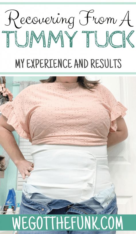 I had a drainless tummy tuck completed in Colorado and am sharing my recovery from a tummy tuck with results and what to expect. Plus Size Mommy Makeover Surgery, Diastasis Recti Surgery Before And After, Abdominal Surgery Recovery Tips, Tummy Tucks Recovery Timeline, Mommy Makeover Must Haves, Tummy Tucks Post Op, Plus Size Tummy Tucks Before And After, Tummy Tucks Recovery List, Tummy Tucks Recovery Tips