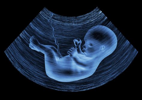 Male Pregnancy, 4d Ultrasound, Pregnancy Ultrasound, Butcher Babies, Baby Ultrasound, Baby Scan, Unborn Baby, Baby Growth, Gay Marriage