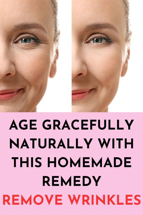 Home Remedies For Wrinkles, Anti Aging Remedies, Wrinkle Remedies, Wrinkle Free Skin, Skin Care Wrinkles, Face Wrinkles, Wrinkled Skin, Deep Wrinkles, Sagging Skin