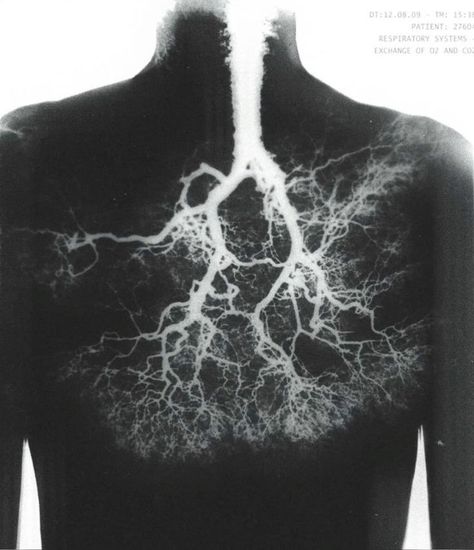 Arte Peculiar, Arte Inspo, Ap Art, Gcse Art, Anatomy Art, Lungs, X Ray, Art Plastique, Halle