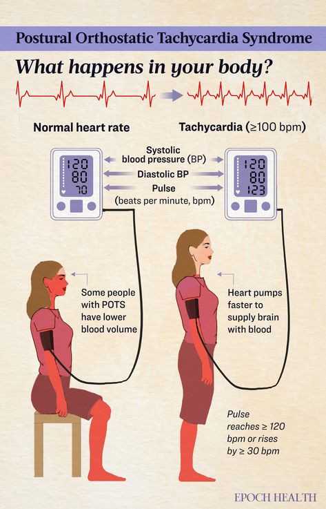 POTS: Symptoms, Causes, Treatments, and Natural Approaches | The Epoch Times Autonomic Nervous System Dysfunction, Dysautonomia Pots, Mast Cell Activation Syndrome, Invisible Disease, Increase Heart Rate, Autonomic Nervous System, Ehlers Danlos Syndrome, Autoimmune Disorder, Patient Experience