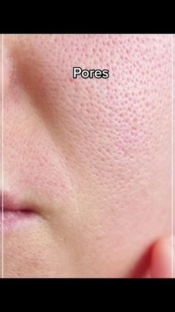 Beginner Skin Care Routine, Men Skin Care Routine, Skin Care Basics, Face Skin Care Routine, Open Pores, Diy Skin Care Routine, Serious Skin Care, Good Skin Tips, Basic Skin Care Routine