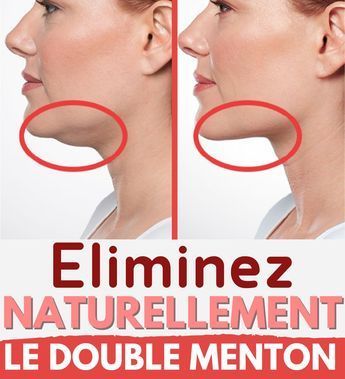 Chin Exercises, Double Menton, Neck Firming, Facial Exercises, Self Confidence Tips, Body Balance, Face Yoga, Senior Fitness, Yoga Gym