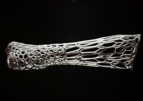 Lattice structure design - DASSAULT: CATIA products - Eng-Tips Heal Broken Bones, Lattice Structure, 3d Printing Architecture, Machine 3d, Bone Fracture, Plaster Cast, Architecture 3d, Medical Technology, Futuristic Design