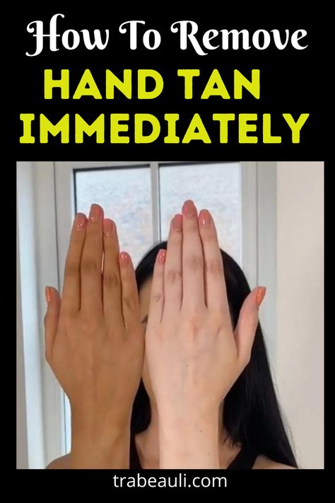 Hand Tan At Home Immediately How To Get Rid Of Sun Tan On Face, Hands Tan Removal At Home, How To Remove Tan From Hand And Face, Remedy For Tanned Hands, How To Remove Hand Hair, Tan Remove From Hands, How To Remove Hand Tanning, How To Remove Skin Tanning, Anti Tanning Remedies