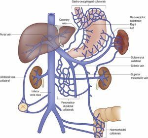 Venous System, Lymph Vessels, Vein Thrombosis, Human Liver, Basic Anatomy And Physiology, Arteries And Veins, Cell Line, Medical Anatomy, Diagram Design