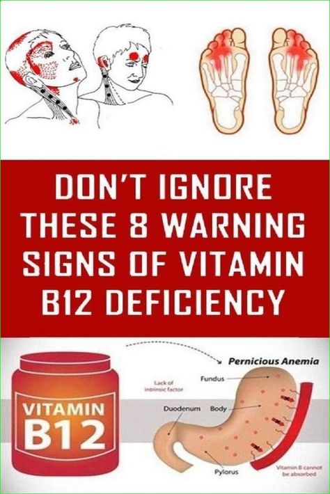 VITAMIN B12 DEFICIENCY SYMPTOMS THAT MOST PEOPLE IGNORE Vitamin B 12 Deficiency Symptoms, Low Iron Symptoms In Women, B 12 Deficiency Symptoms, Benefits Of B12, Vitamin B12 Deficiency Symptoms, Brain Vitamins, B12 Deficiency Symptoms, Deficiency Symptoms, B12 Deficiency