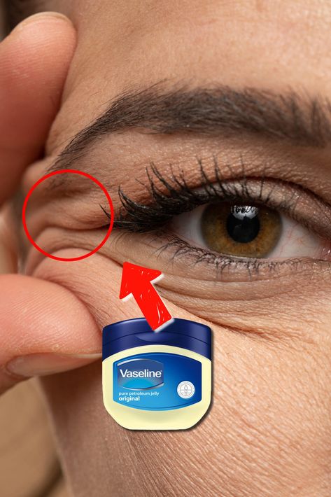 Vaseline Under Eyes, Vaseline Eyebrows, Baking Soda Under Eyes, Vaseline Uses For Face, Vaseline For Face, Eyelid Wrinkles, Eyes Wrinkles, Wrinkles Remedies Face, Baking Soda Face Mask