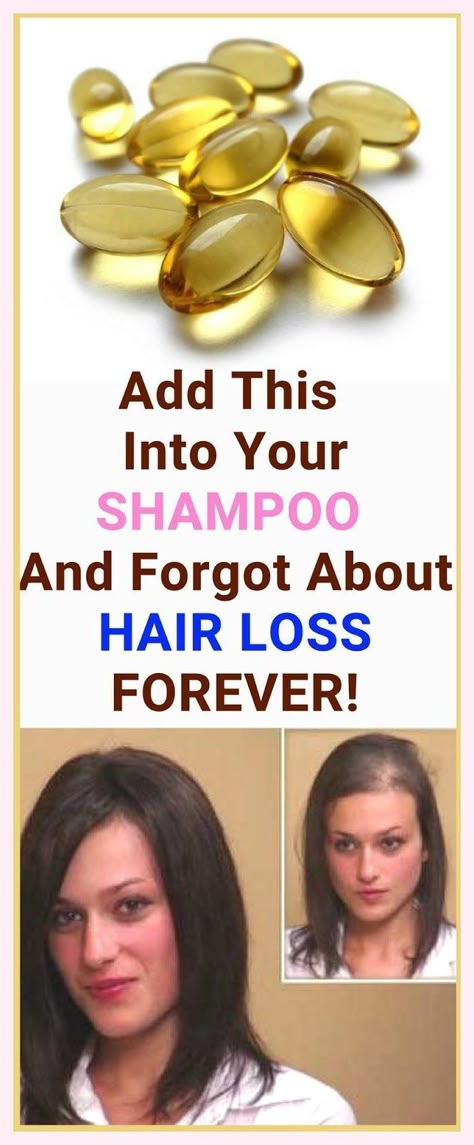 She Added This into Her SHAMPOO and Forgot About Hair Loss FOREVER! She Now Recommends Her Trick To Everyone! Home Remedies For Hair, Grow Hair Faster, Hair Remedies, Hair Treatments, Natural Beauty Tips, Thinning Hair, Spicy Recipes, Grow Hair, Hair Health