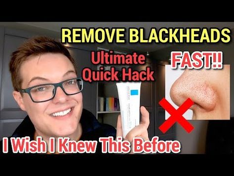 (1) REMOVE SEBACEOUS FILAMENTS FAST - Blackhead Removal With La Roche-Posay Cicaplast Baume - YouTube Black Dots On Nose, Cicaplast Baume B5, Sebaceous Filaments, Blackhead Removal, Face Forward, Roche Posay, I Wish I Knew, La Roche Posay, Blackhead Remover