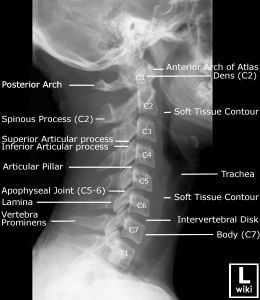 Anatomy Labeled, Radiographic Anatomy, Punkty Spustowe, Radiology Schools, Radiologic Technology, Medical Items, Radiology Student, Radiology Imaging, Radiology Technologist