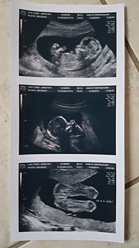 Ultrasound Prank, Fake Ultrasound, Baby Ultrasound Pictures, Arte Ganesha, Girl Scout Troop Leader, Ultrasound Technician, Baby Ultrasound, Ultrasound Tech, Fake Baby