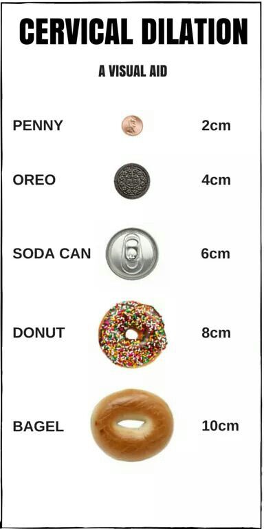 Cervical dilation in relative terms Cervical Dilation, Newborn Nursing, Child Nursing, Ob Nursing, Nursing Mnemonics, Nursing School Survival, Nursing School Studying, Nursing School Tips, Nursing School Notes