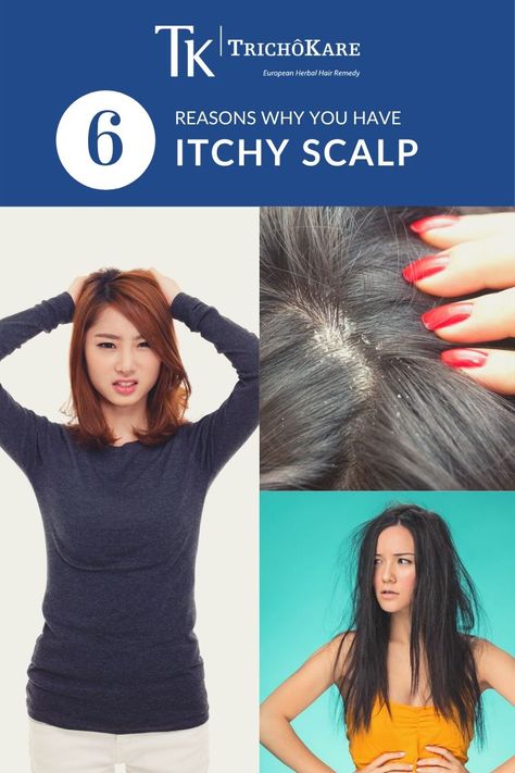 It can be frustrating when you are literally scratching your head over why your scalp itches. Here are some common causes for an itchy scalp and what you should do for relief. Head Itching Remedies, Itching Remedies, How To Remove Dandruff, Scalp Itch, Dandruff Remedy, Anti Itch, Herbal Hair, Itchy Scalp, Hair Remedies