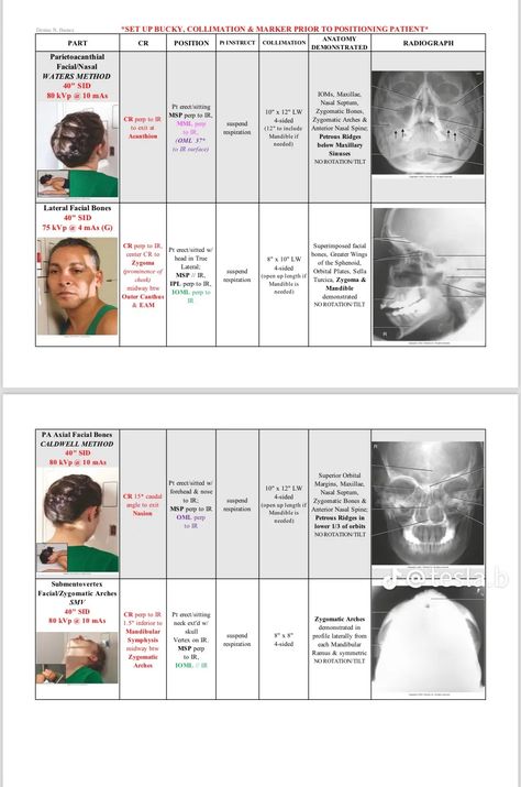 Image Production Radiology, Rad Tech Student, Radiology Schools, Radiology Student, Radiology Imaging, Radiology Tech, Radiology Technologist, Medical Student Study, Rad Tech