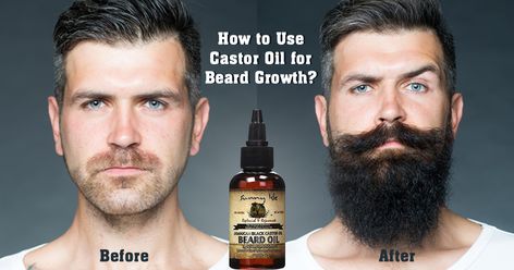 Beard Oil Recipe, Facial Hair Growth, Accelerate Hair Growth, Hair Growth For Men, Castor Oil For Hair Growth, Thick Beard, Beard Growth Oil, Face Routine, Castor Oil For Hair