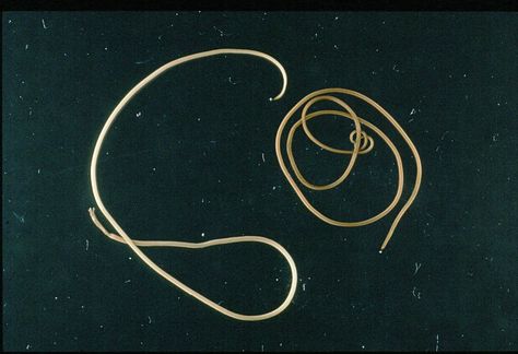 Parasitic Horsehair Worms: Facts, Life Cycle, and Effects Parasitic Worms, Healthy Horses, A Bug, Horse Hair, Life Cycles, Food Animals, Bugs, Hoop Earrings, Horses