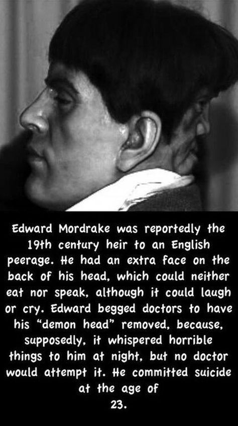 Edward Mordrake Edward Mordrake, Interesting History, Two Faces, Scary Stories, Ghost Stories, American Horror, Horror Stories, American Horror Story, True Stories